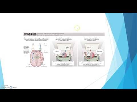 Sperry (1968): Split-brain Study