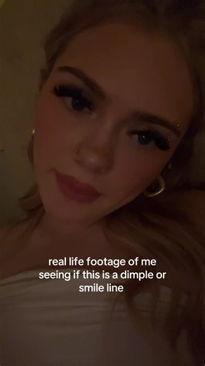 Exploring Dimples: Dimple or Smile Line?