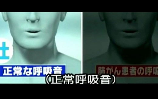 听听正常人和肺癌患者呼吸音---为观众朋友奉献
