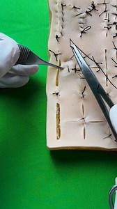 8.9K views · 70 reactions | A stitch series (part 2): cross stitch | Dermhacks | Facebook