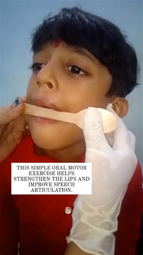 "Oral Motor Exercise – Improves lip closure, speech clarity , Drooling & swallowing." This simple oral motor exercise helps strengthen the lips and improve speech articulation. Useful for children with speech delay, drooling, or low oral muscle tone. Follow Divine Light Special #SpeechTherapy #OralMotorExercise #SpecialNeedsTherapy #SpeechDelayHelp #CerebralPalsySupport #TherapyActivities #OccupationalTherapy #SpeechDevelopment #ChildTherapy #SpecialNeedsParenting #SpeechImprovement #TherapyForK