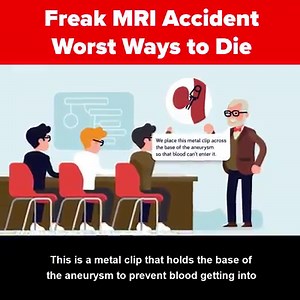 Laying with your back on the MRI table is already a scary experience, but in today's insane new video we're going to show you some of the worst freak MRI accidents that even left some people dead! And not to freak you out even more, but this wasn't a one time occurrence and happened to several victims. See their tragic stories here, in worst ways to die - freak MRI accidents. | The Infographics Show