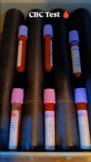 CBC Test Kaise Kiya Jata Hai | Nursing Student | Training | Blood Test #nursing #doctor #hospital