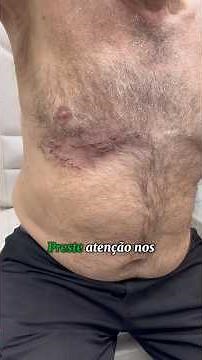 Chest and back pain