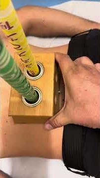 Alívio da Dor Lombar com Moxa Bastão – Acupuntura Médica na Prática!