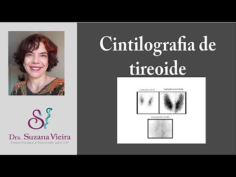 O que é e para que serve a cintilografia de tireoide