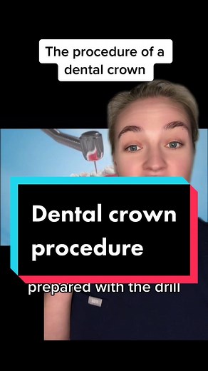 Dental Crown Procedure: A Step-by-Step Guide