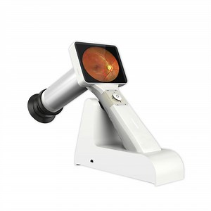 [Hot Item] Hfc-01 Handheld Ophthalmic Product Digital Retinal Eye Non-Mydriatic Fundus Camera