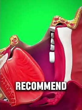 Tonsil Stones? Here’s How to Remove Them (3D Animation)#shorts