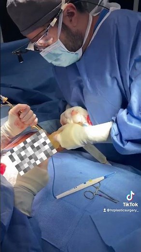 Ruptured breast implant removal by Dr. Afshari 😲