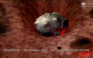 医学3D动画：人体内的旅行，用不同的视角了解人体及疾病