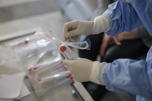 France has recorded its highest number of new Covid-19 cases since late May / The surge relates to the number of PCR tests carried out but also to contact tracing flaws, and slow decision-making