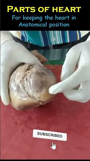 Heart Anatomy: Parts for full video in description. #anatomy #heart #medical #mbbs #medicallectures