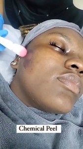 1.1K views | Remove dead skin , clear congestion , brighten skin with...