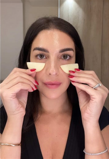 Potato Eye Pack for Dark Circles: Natural Remedy