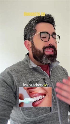 Brackets en todos los dientes? Aquí te cuento la verdad #brackets #dientes #ortodoncia #dentista #braces