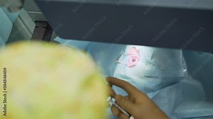Laser vision correction. Eye surgery. Ophthalmology operation