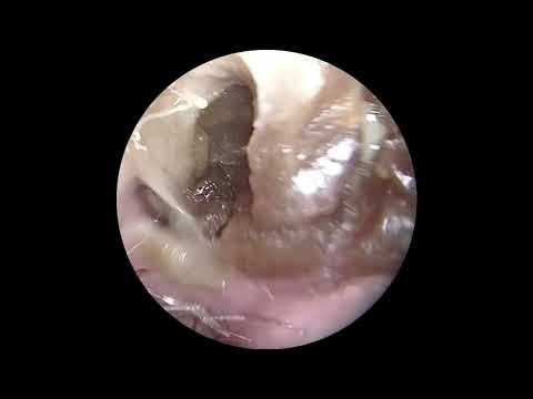 Booger removal | Are boogers good or bad for you ?