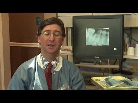 Tooth Abscess : Wisdom Tooth Abscess Symptoms