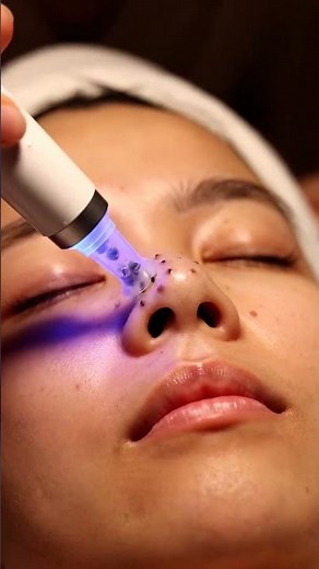 POV Spa Treatment: Nose Bridge Clearing with Transparent Pore Vacuum | Realistic Micro-Detail #asmr