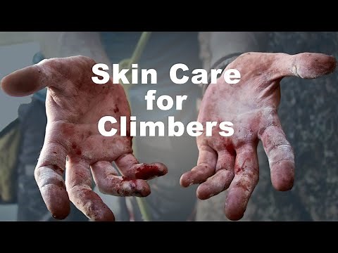 Skin Care - Prevention and Repair | Hand Care for Climbers Part 1