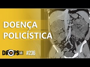 DOENÇA RENAL POLICÍSTICA NOS EXAMES DE IMAGEM