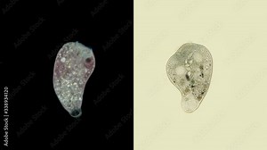 Infusoria Stentor under the microscope, the family Stentoridae, class Ciliata, feed on small organic residues, bacteria, algae, protozoa.