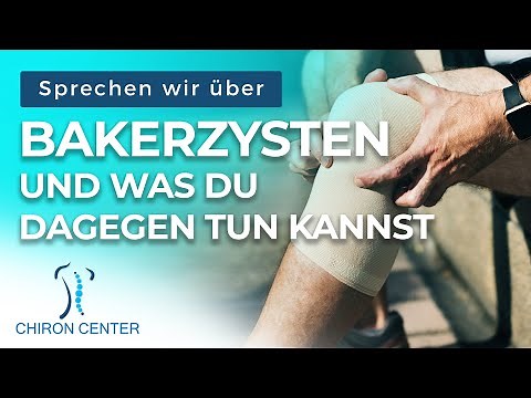 Bakerzysten und was du dagegen tun kannst I der Faszientherapeut des Faszienzentrums Hamburg erklärt