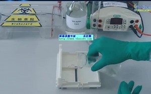 逆转录聚合酶链式反应(RT-PCR)