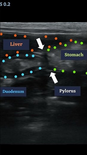 Ultrasound of the Pylorus in a dog