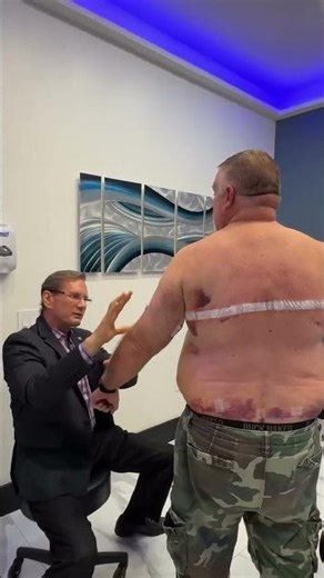 From Surgery to Smile in Just 10 Days #surgeryshorts #medicalshorts