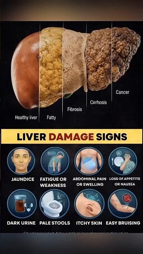 Early Warning Signs of Liver Damage You Should Not Ignore
