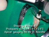 Endodontics - basic principles • Video • MEDtube.net