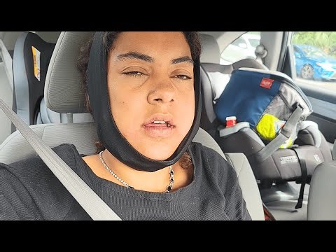 I just got all 4 of my wisdom teeth pulled out 🦷🦷🦷🦷