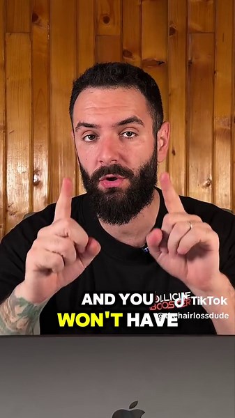 Amazing Beard Growth Results with Minoxidil - Two Month Transformation!