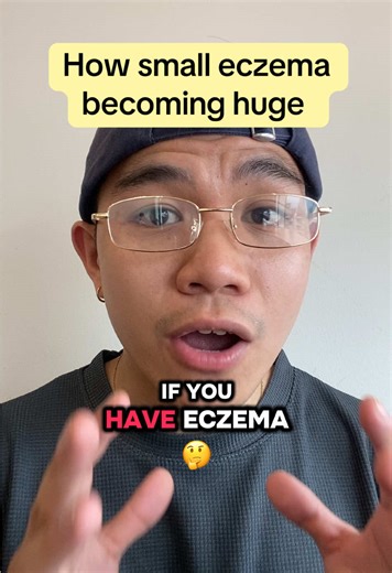 Eczema Expansion: Ignoring One Spot Can Affect Your Body