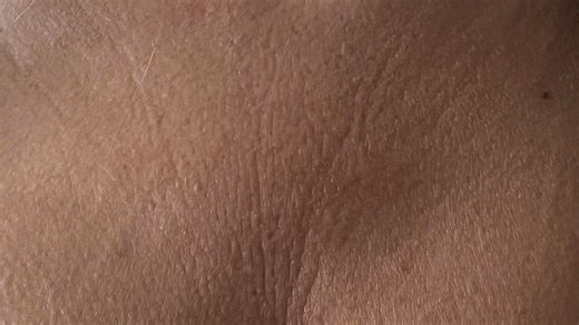 Woman details how she reversed her chest wrinkles with a $6 Trader Joe's buy