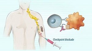32 reactions | Innovative immunotherapies are changing the way cancer is treated. Checkpoint blockade works to unleash the immune response and block receptor activation. | Bayer | Facebook