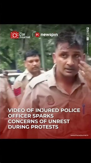 Video of Injured Police Officer Sparks Concerns of Unrest During Protests