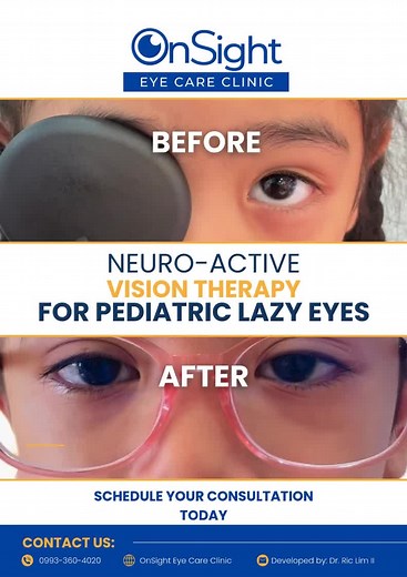 OnSight Eye Care Clinic on TikTok