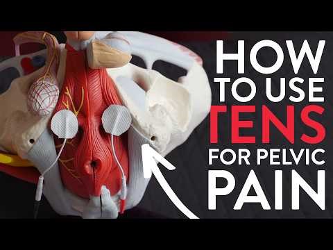 How to Use a TENS Unit for Pelvic Floor Pain Relief