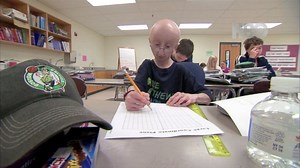 Sam Berns, Boy With 'Aging Disease' Progeria, Dies at 17