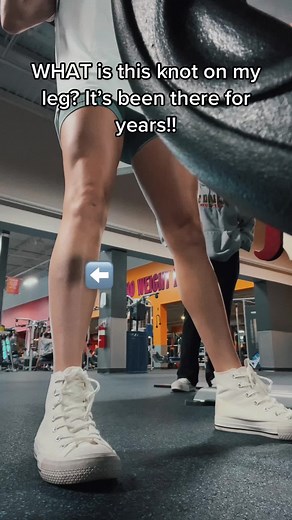 pops up to say hello sometimes #gymtok #knot #workingout #medicalquestion