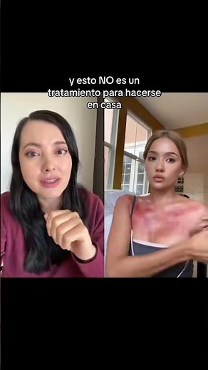 STOP DAMAGING YOUR SKIN WITH DIY TREATMENTS, Dermatologist explains