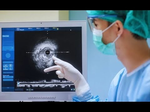 Use Sound Waves to Remove Tumors Without Surgery
