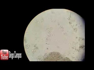 Trichomonas hominis - Coproanalisis