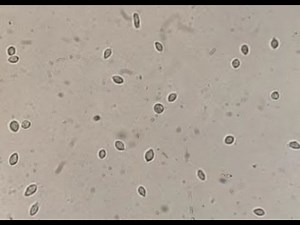 Live Trichomonas vaginalis in Diamond's medium