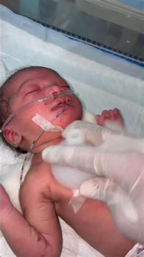 Chestryped for newborn baby😌 #sumitnicunursingstm #youtubeshorts #nursin #newbornbaby #chestworkout