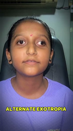 Truth About Squint Cross Eye Treatment Glasses & Surgery Only – No Magic Cure