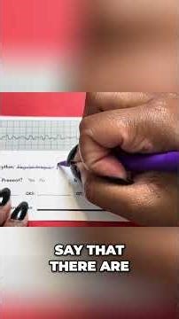 Can you identify V-Fib? #monitortech #nursingstudent #cardiacmonitoring #nursingschool #nursing #ekg